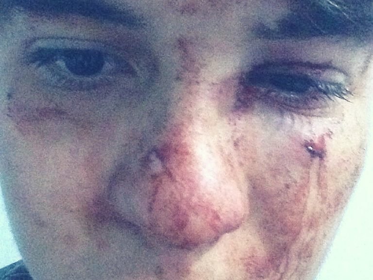 Agentes de tráfico de Santa Marta le dieron paliza a infractor que exigió su comparendo