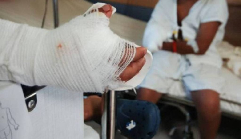 ¡No aprenden!: Varios niños quemados con pólvora en el Magdalena
