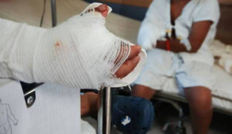 ¡No aprenden!: Varios niños quemados con pólvora en el Magdalena