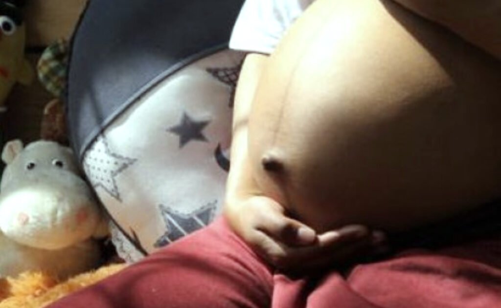 Zona Bananera registra más de 500 casos de menores en embarazo