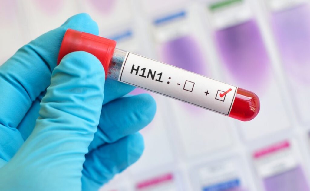 Alerta por H1N1 en Santa Marta: estas son las medidas de las autoridades