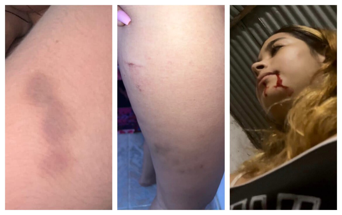 Viviana Martínez, publicó algunos videos e imágenes de las agresiones en sus redes sociales (2)