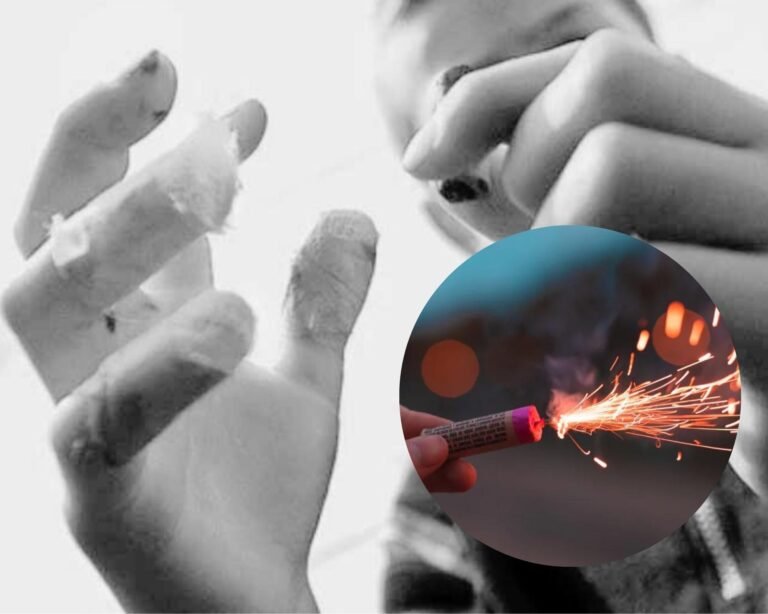 Once lesionados con pólvora en nueve municipios del Magdalena