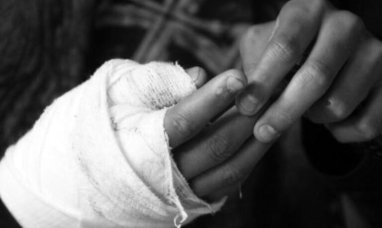 Un joven de Salamina, es el primer quemado con pólvora en el Magdalena